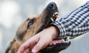 How Our Personal Injury Lawyers Can Help if You’ve Been Bitten by a Dog in San Antonio 